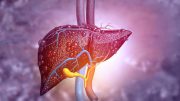 Nuclear Magnetic Resonance to Detect Fatty Liver Disease