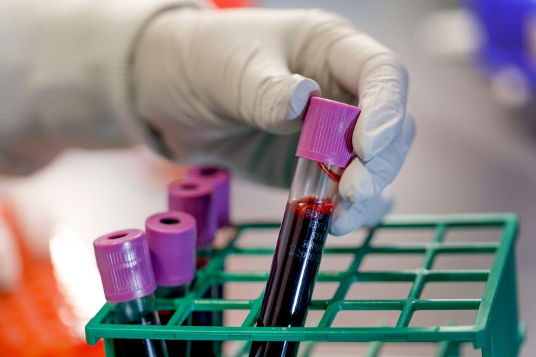 OHSU Laboratory Blood Sample