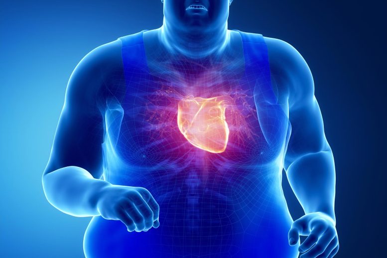 Obese Man Exercise Heart Attack Illustration