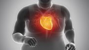 Obese Man Exercise Heart Injury Illustration