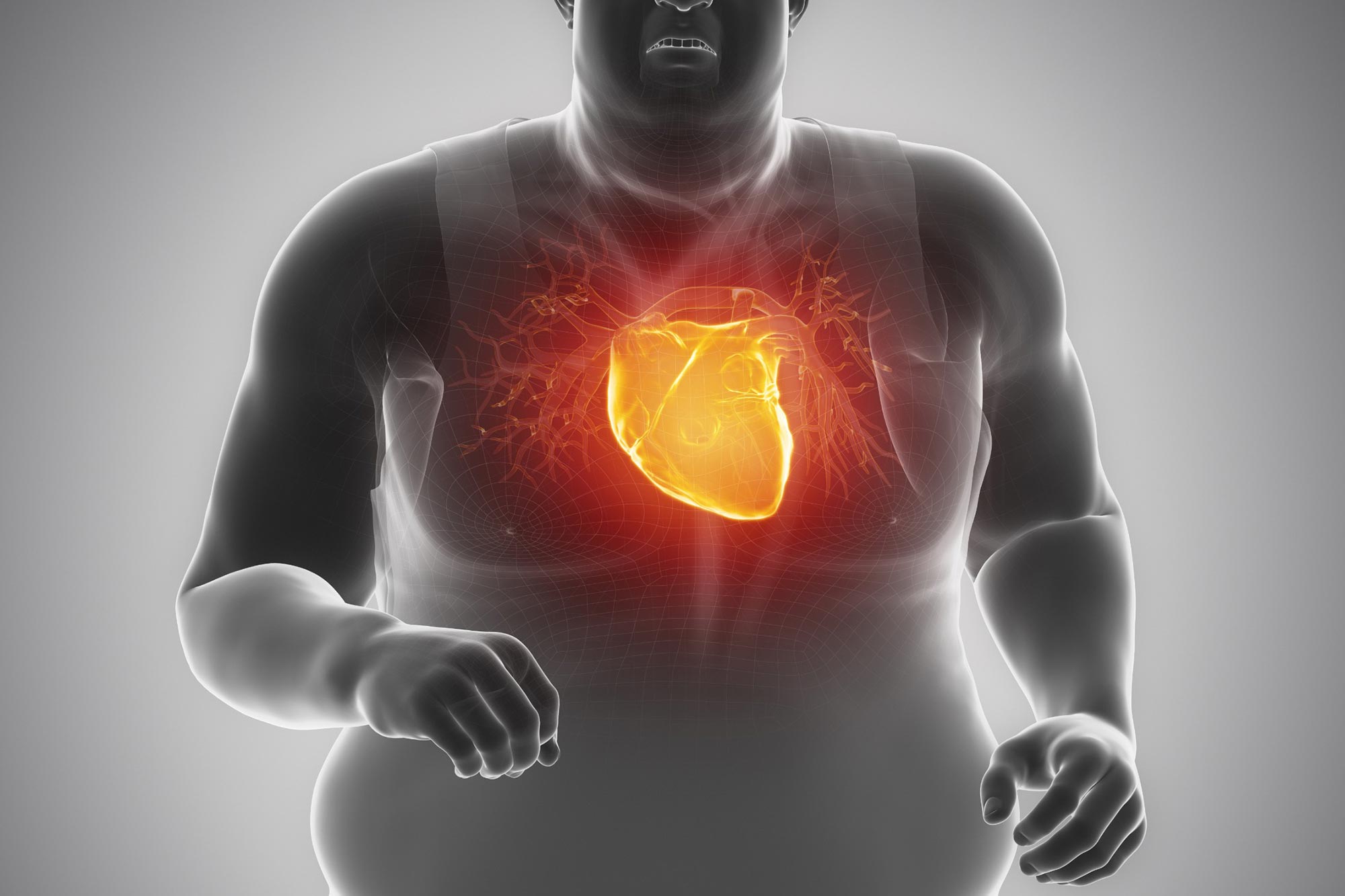 How Losing Weight Affects Your Cardiovascular Health: Cardio Metabolic  Institute: Multi-Specialty Group