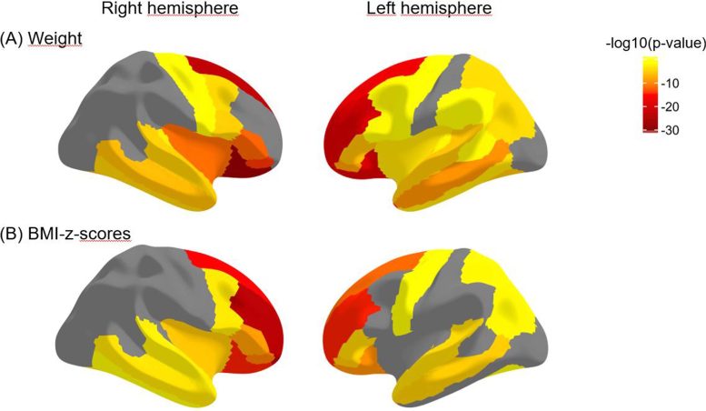 Obesity Cortical Thickness of Prefrontal Regions