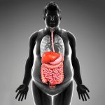 New Research Finds That With Obesity, the Problem Isn't an Excess ...