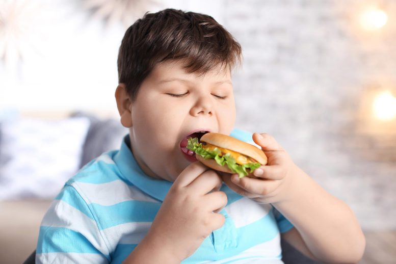 Obesity Overweight Boy Eating Burger