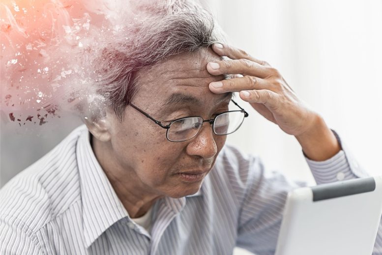 Old Man Alzheimer's Dementia