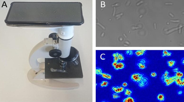 Optical Nanomotion Detection Based Antibiotic Susceptibility Test