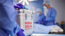 Organ Transplant Hospital