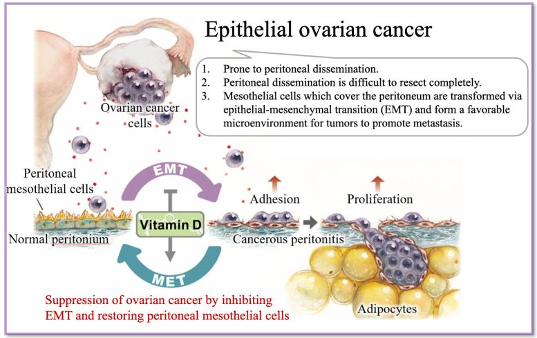 Ovarian Cancer Graphic