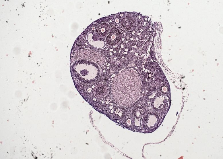 Ovarian Tissue Section