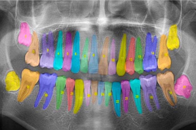 Synthetic Intelligence Takes the Guesswork Out of Dental Care