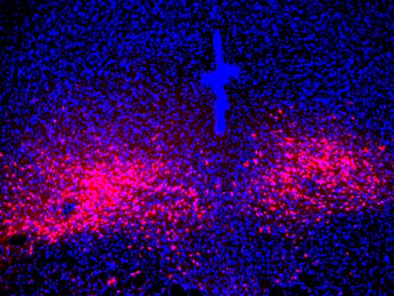 PAC1R-expressing dorsal raphe neurons in the mouse brain (red) serve as the projection targets for PACAP parabrachial neurons to mediate panic-like behavioral and physical symptoms. Credit: Salk Institute