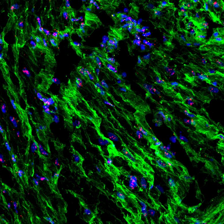 PIEZO1 Expression in Human Uterine Smooth Muscle