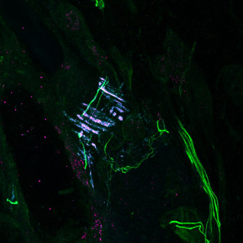 PIEZO2, Filamin B, and the Neuronal Marker Neurofilament Heavy Chain