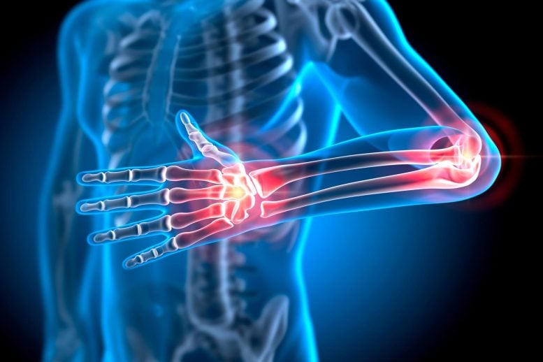 Painful Hand and Elbow Joints Bones