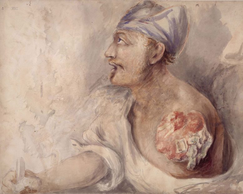 Painting of a One Armed Soldier Writing With a Quil