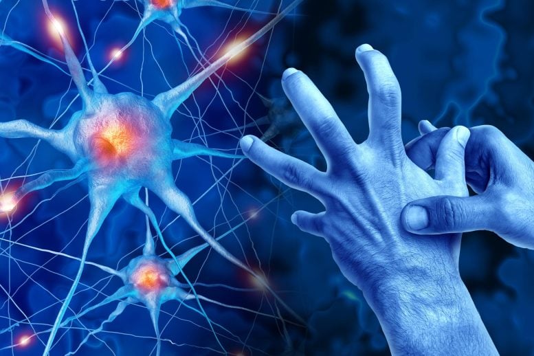 Scientists Say a Major Assumption About Parkinson’s Disease May Be Wrong