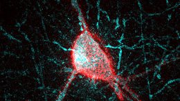Parvalbumin Interneuron Surrounded by the Perineuronal Net