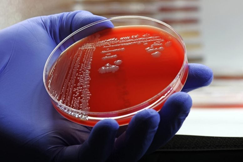 Petri Dish Superbug Methicillin Resistant Staphylococcus aureus (MRSA) Bacteria