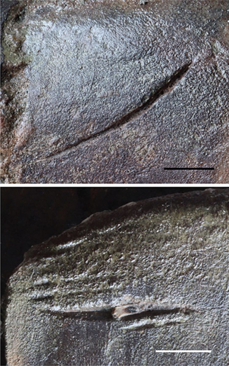 Photograph of the Bite and Embedded Tooth