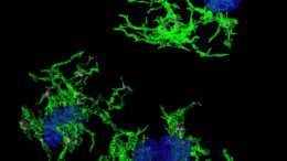Plaque-Eating Microglia