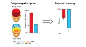 Researchers Find A Link Between Poor Sleep Memory Loss And Brain