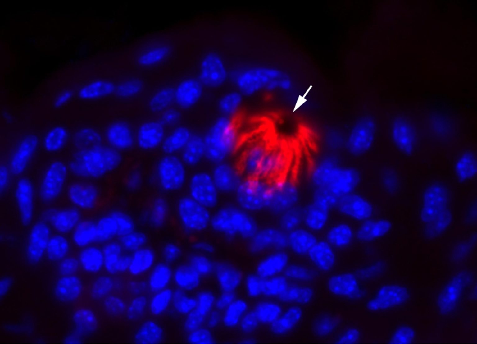 Researchers Examined What COVID19 Does to Taste Bud Cells Here’s