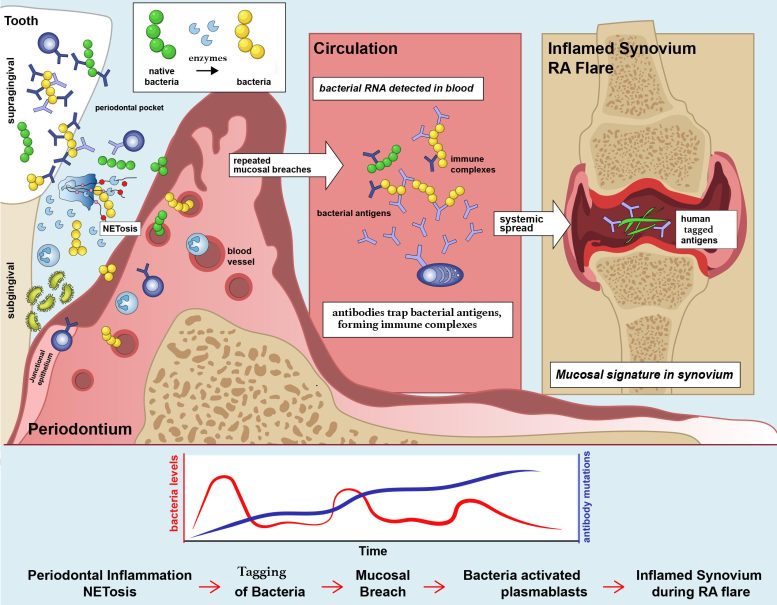 Proposed Model for the Role of Periodontal Inflammation in Rheumatoid Arthritis