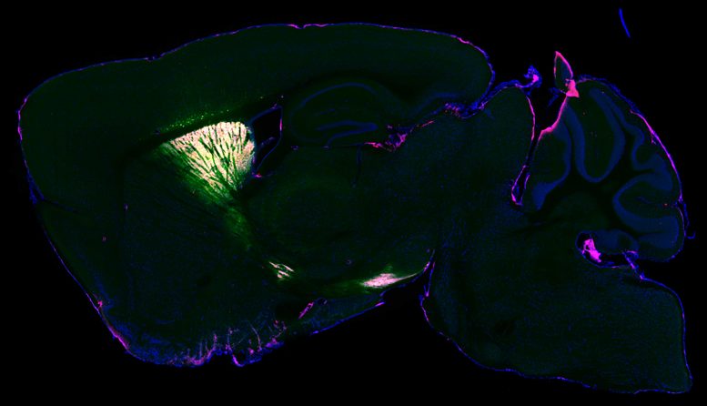 Protein Expression Mouse Brain