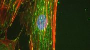 Proteins Inside Adult Bone Marrow-Derived Stem Cells