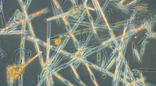 Pseudo-nitzschia is among the species that produce toxins and cause harmful algal blooms. Credit: Courtesy of Raphael Kudela, UCSC