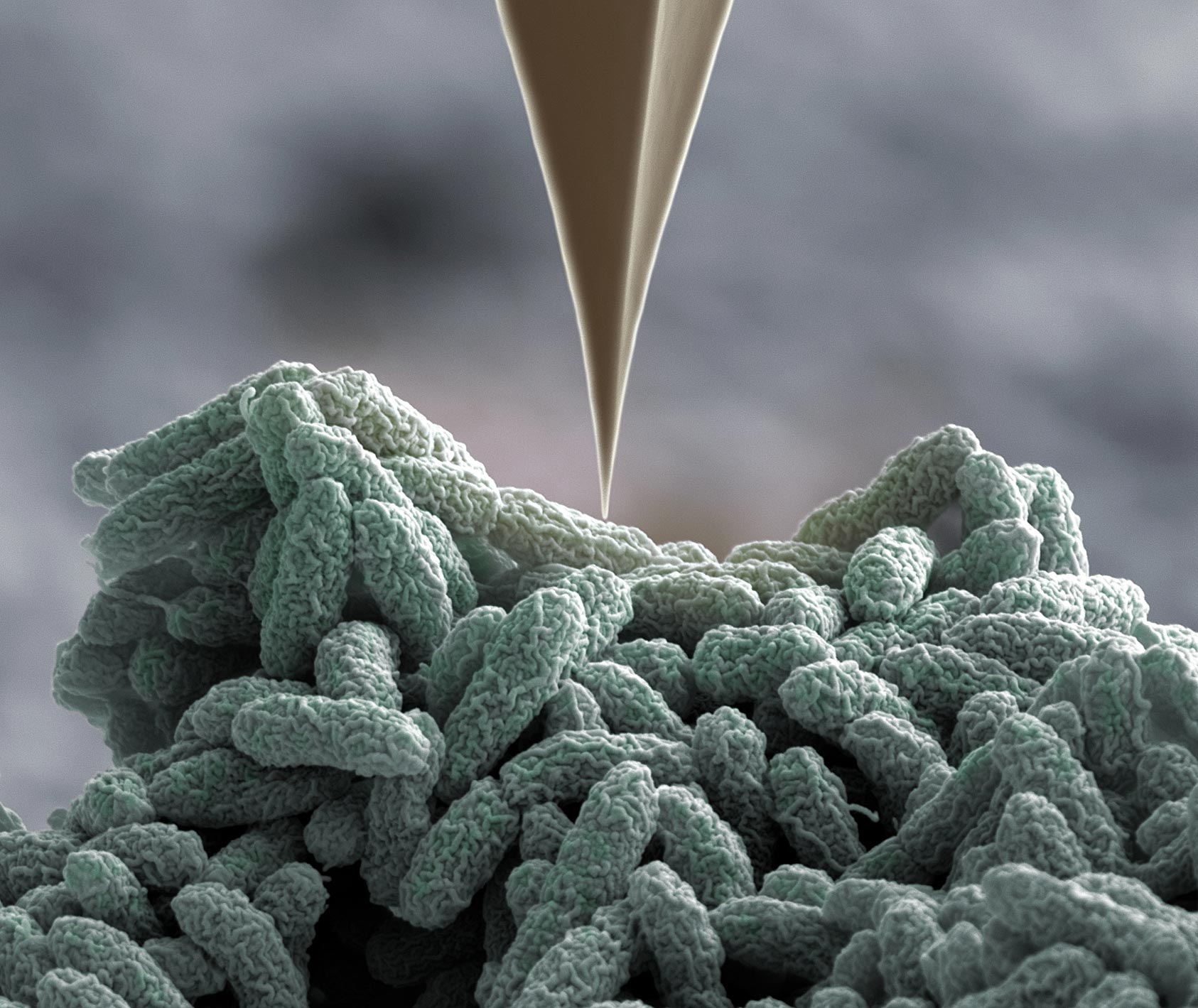 Microscopic Warfare: These Bacteria Deploy Tiny Spearguns To Fight