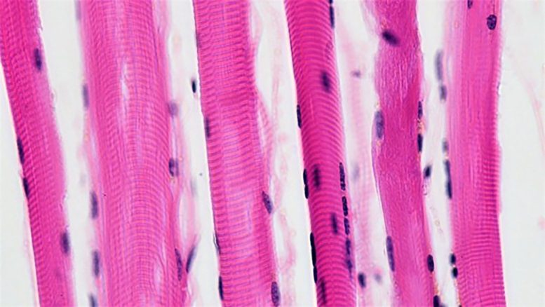 Pterostilbene Effects on Skeletal Muscle Cells