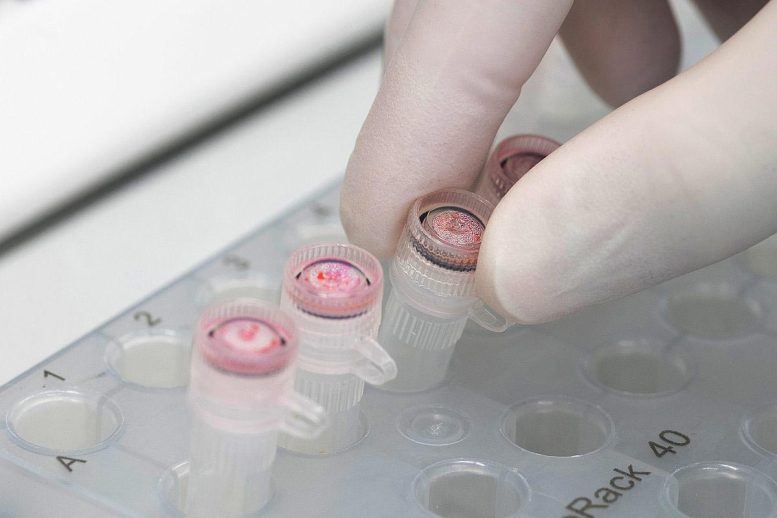 RBP4 Activates Latent HIV in Laboratory Samples
