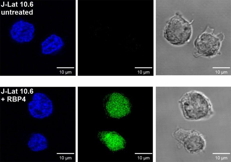 RBP4 Reactivates Latent HIV in T Cells