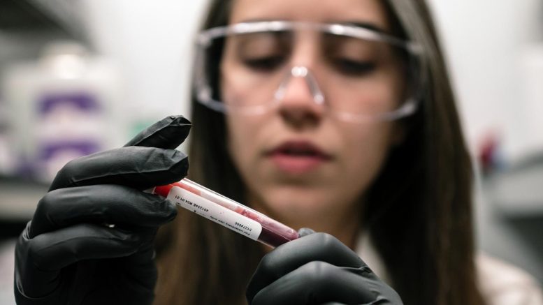 Red Blood Cells Glucose Sink at High Altitude