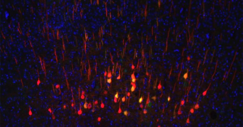 Regenerating Neurons Mouse Brain