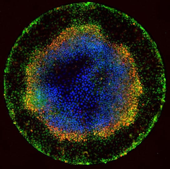 Researchers Coax Human Embryonic Stem Cells to Organize