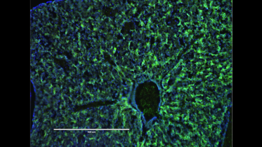 Researchers Cure Blood Disorder in Fetal Mice