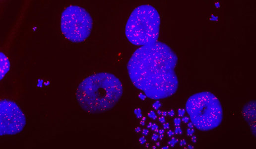 Researchers Discover New Cancer Cell Vulnerability