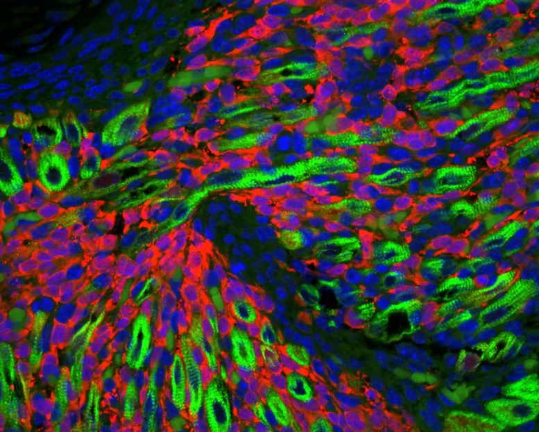 Researchers Discover the Cell Type That Gives Rise to Rhabdomyosarcoma