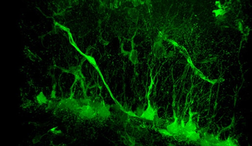 Researchers Find Trigger of New Brain Cell Growth