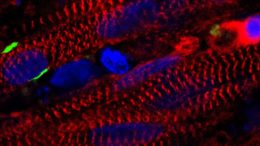 Researchers Grow Functioning Human Muscle from Skin Cells