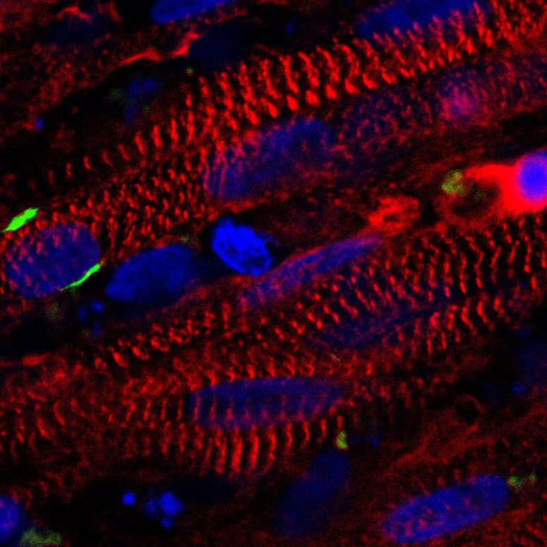 Researchers Grow Functioning Human Muscle from Skin Cells