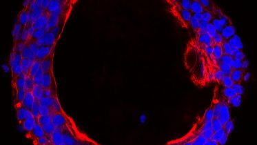 Researchers Identify Sugar-Attaching Enzyme That Defines Colon Cancer