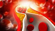 Researchers Identify Tiny RNA That Controls Cholesterol