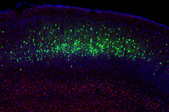 Researchers Reprogram Neurons