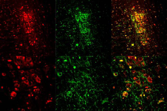 Researchers Use Optogenetics to Tigger REM Sleep