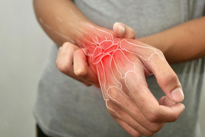 Rheumatoid Arthritis Wrist Joint Pain