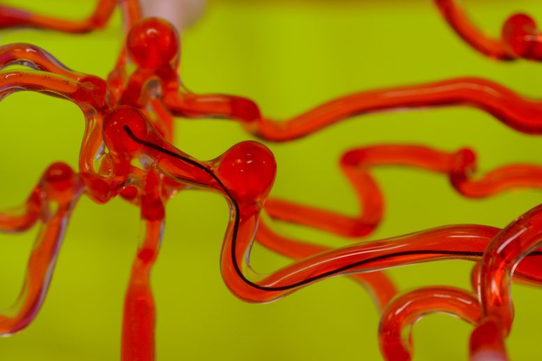 Robotic Thread Through Brain Blood Vessels