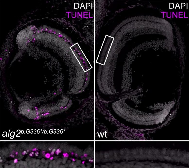 Rod Cell Death in Alg2 Mutant Fish Embryos
